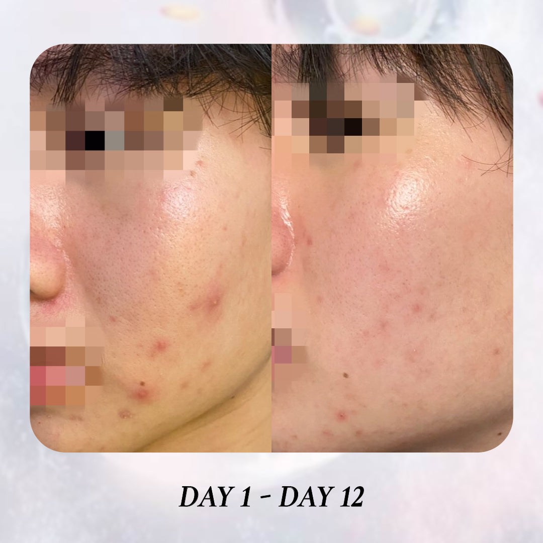 3X PHYTO REPAIR ESSENCE