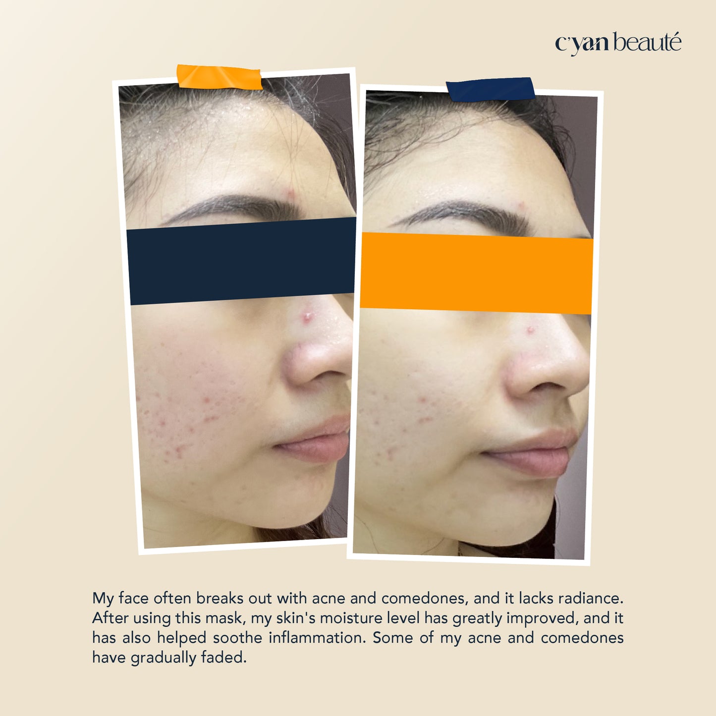 Fermented Tremella Moisturizing Treatment Mask