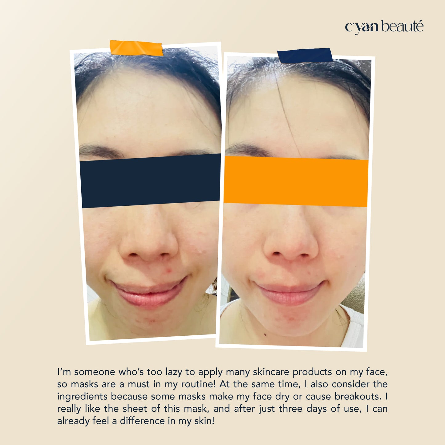 Fermented Tremella Moisturizing Treatment Mask