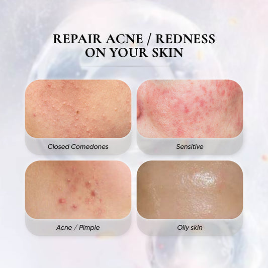 3X PHYTO REPAIR ESSENCE